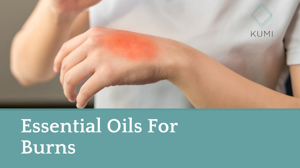 Essential Oils For Burns