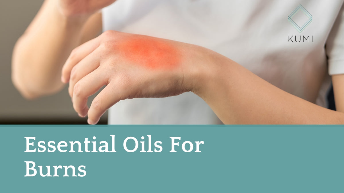 Essential Oils For Burns Kumi Oils