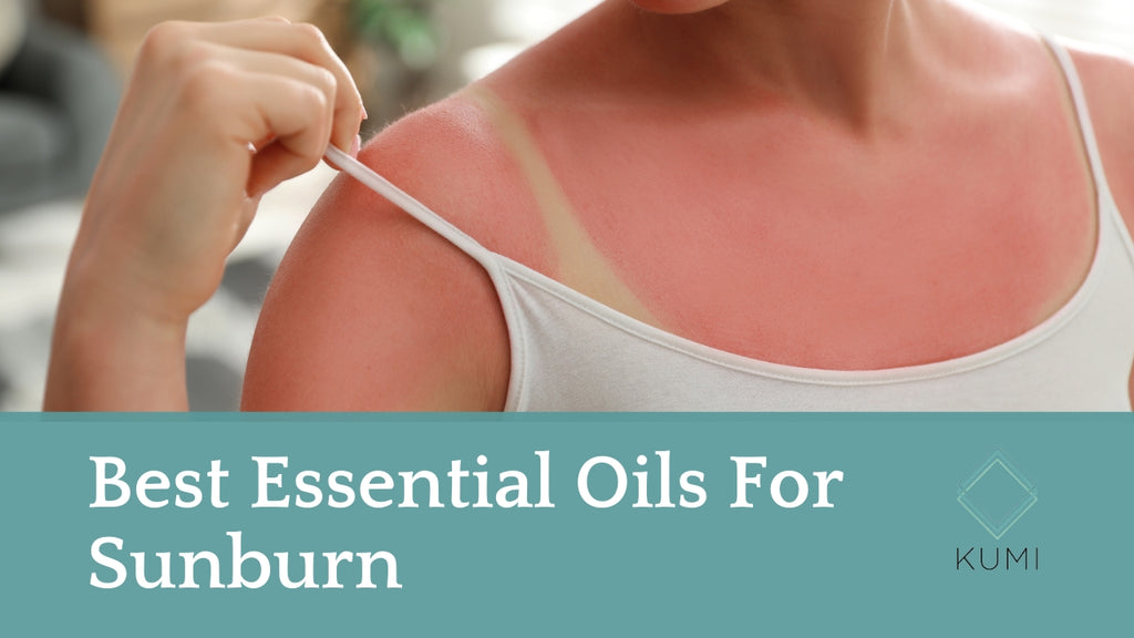 Best Essential Oils For Sunburn